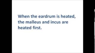 Caloric test Mechanism of Caloric Nystagmus [upl. by Bunny]