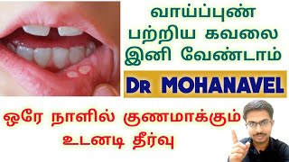 வாய்ப்புண்Mouth Ulcer உடனடியாக குணமாகHome RemediesTamil Dr MOHANAVEL [upl. by Heindrick]