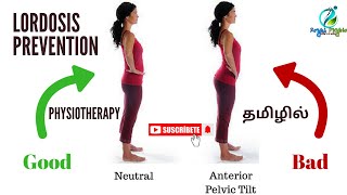 lumbar lordosis tamil  lordosis treatment in tamil  how to prevent lumbar lordosis  physiotherapy [upl. by Laina]