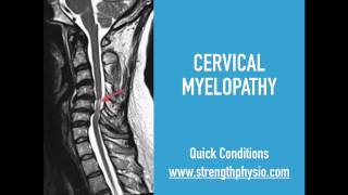 Cervical Spine Myelopathy [upl. by Mendy]