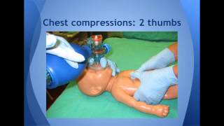 Resuscitation of Newborn Infants [upl. by Lombardo]