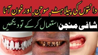 teeth swollen treatment Danto ki pelahat ka ilaj  bleeding from teeth 2024 [upl. by Bauer182]