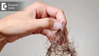 What are causes of severe hair fall like 100 strands daily  Dr Nischal K [upl. by Hakeber40]