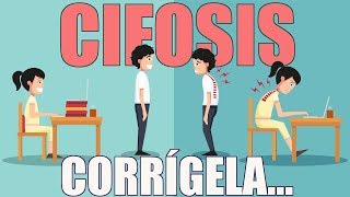 Corrige la CIFOSIS en 3 pasos  Higiene Postural [upl. by Amalle955]