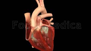 Paroxysmal atrial fibrillation  Animated Atlas of Atrial Fibrillation [upl. by Enomar263]