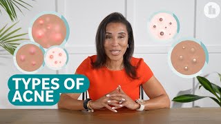 The Different Types of Acne and How to Treat Them [upl. by Aiveneg]