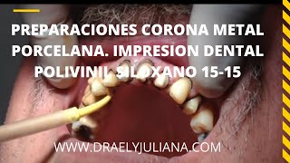 Preparación de Coronas Metal Porcelana 👅 video1515 Impresión Definitiva PolivinilSiloxano [upl. by Jolie]