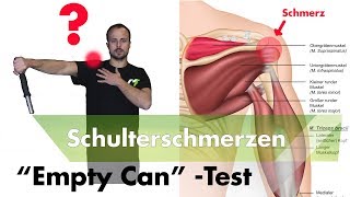 Schulterimpingement Testen  Supraspinatussehne Entzündet [upl. by Anaujal]