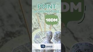 POINT D’ACUPUNCTURE  10DM  Ling Tai acupuncture acupuncturepoints medecinechinoise [upl. by Niwrad]