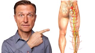 Say Goodbye to Sciatica Nerve Pain in 5 Minutes [upl. by Eednac]