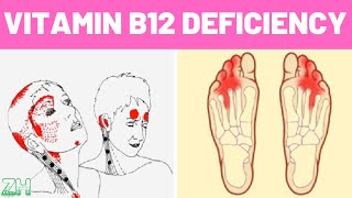 Vitamin B12 Deficiency Symptoms That Should Never Be Ignored [upl. by Tivad]