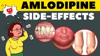 Amlodipine Side Effects amp How to Avoid  Amlodipine Adverse Effects [upl. by Nnodnarb]