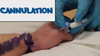 How to Perform Cannulation  OSCE Guide old version  UKMLA  CPSA [upl. by Rainwater]