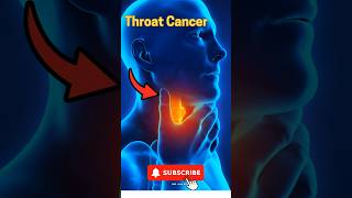 5 Key Symptoms of Throat Cancer  Recognize the Warning Signs [upl. by Gertie]