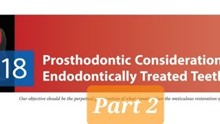 Prosthodontic Considerations in RCT Treated Teeth 2Factors affecting post selectionTypes of Posts [upl. by Ellenrahs949]