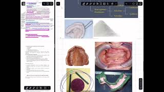 شرح prosthodontics lec 5 impression material and techniques for RPD طب اسنان مرحله رابعه [upl. by Tacita73]