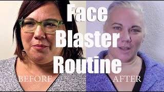 My FaceFascia Blaster Routine using Ashley Blacks Face Blaster [upl. by Veedis]