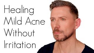 HOW TO TREAT ACNE WITHOUT IRRITATING YOUR SKIN [upl. by Ethbun]