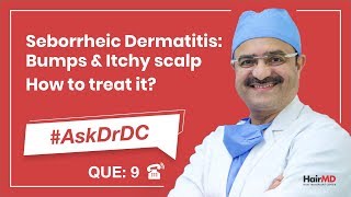 How To Treat Seborrheic Dermatitis कैसे seborrheic का इलाज करे  AskDrDc Ep 9  In HINDI [upl. by Deth]