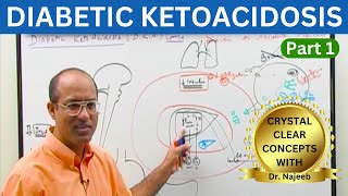 Diabetic Ketoacidosis  Symptoms  Causes  Diagnosis  Part 1 👨‍⚕️ [upl. by Fihsak]