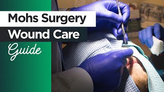 Caring for Your Wounds after Mohs Surgery A Guide for Patients [upl. by Isayg]