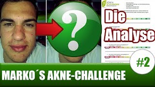 Was hilft gegen Pickel  Marko´s AntiAkneChallenge 2 Die Analyse [upl. by Connell565]