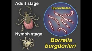 LongerTerm Therapy for Lyme Disease [upl. by Aihgn445]