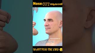 Nose cut ആയാൽWAIT FOR THE END 😯 [upl. by Nawk]