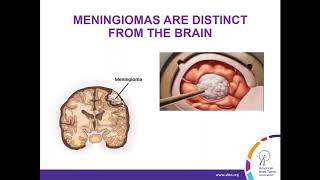 WEBINAR Treatment Strategies for Meningioma [upl. by Hedgcock942]