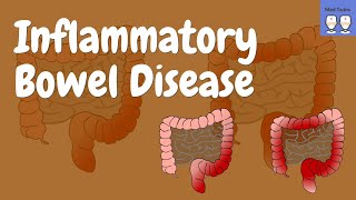 Inflammatory Bowel DiseaseCrohns Disease VS Ulcerative Colitis Pathophysiology Signs amp Symptoms [upl. by Glynnis]