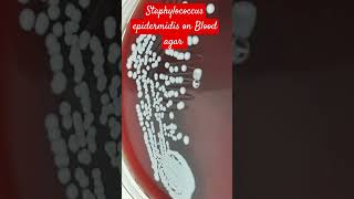 Staphylococcus epidermidis Colony Morphology on Blood Agar [upl. by Huckaby]