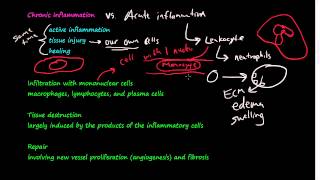 28  Chronic Inflammation  Introduction Macrophages [upl. by Tonl]