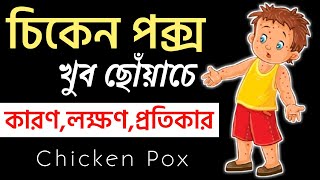 CHICKEN POX advice in BENGALI  POX hole ki ki KHETE hoy [upl. by Dori606]