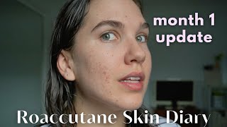 Roaccutane Daily Skin Diary  Taking Accutane For A SECOND Time  Month 1 [upl. by Cornela]