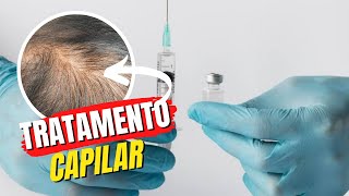 Tratamento Capilar com Intradermoterapia e MMP [upl. by Strep667]