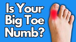 Big Toe Numbness Try THIS For Relief [upl. by Xuaegram588]