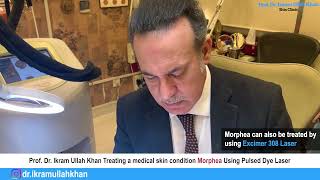 Morphea No More Pulsed Dye Laser Therapy Unveiled for Treatment morpheatreatment lasermachine [upl. by Nessie]