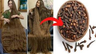 Cloves For Hair Growth Use Cloves To Get Thicker Hair In Less Than 30 Days 🤫 Long Hair Care [upl. by Ppik404]