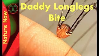 Daddy Long Legs  Myth or Legend [upl. by Milla877]