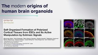 Rescuing Phenotypes in PTHSDerived Brain Organoids with Alysson Muotri [upl. by Nileve]