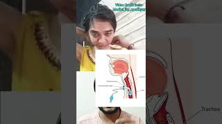 Tracheostomy amp tube youtubeshorts medical [upl. by Latta]