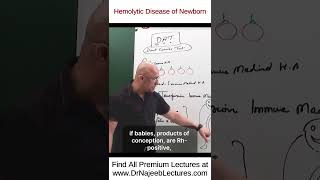 Hemolytic Disease of Newborn drnajeeb drnajeeb drnajeeblectures shorts [upl. by Ecnerol249]