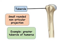 Tubercle Bone Marking [upl. by Sldney]