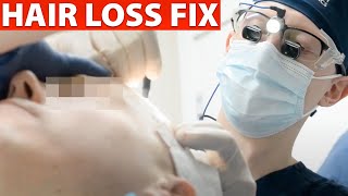 Hair Transplant Surgery Live Full Procedure GRAPHIC [upl. by Key315]