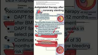 Antiplatelet therapy after coronary stenting [upl. by Ardnekal]