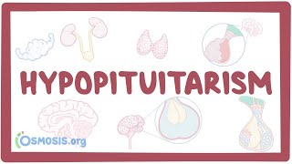 Hypopituitarism  causes symptoms diagnosis treatment pathology [upl. by Farley104]