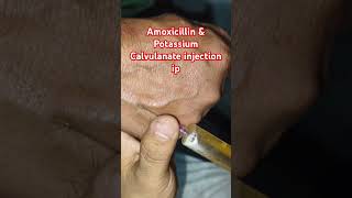 Amoxicillin amp potassium Calvuanate injection ipshrort trending medicalprocedure drxsachin12 [upl. by Winter150]