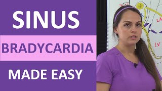 Sinus Bradycardia ECGEKG Interpretation Causes Treatment Nursing NCLEX Review Cardiac [upl. by Nalyk]