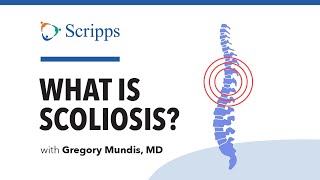 Scoliosis Symptoms and Treatment with Dr Gregory Mundis  San Diego Health [upl. by Ytteb]