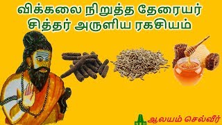 விக்கலை நிறுத்த தேரையர் சித்தர் அருளிய ரகசியம்  Vikkal Tamil Medicine [upl. by Kamila]